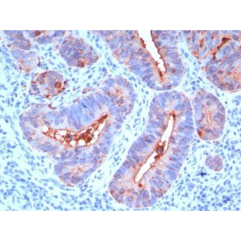 CD66 (CEA)(C66/195), 1mg/mL