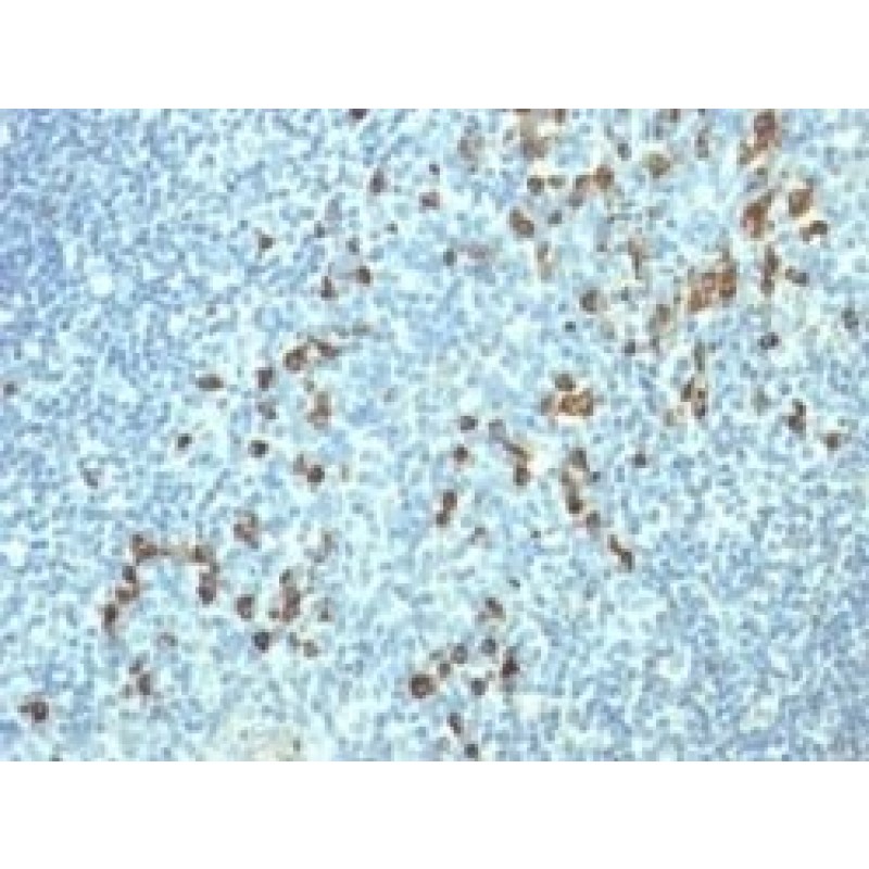 Human Lambda Light Chain(HP6054), 1mg/mL