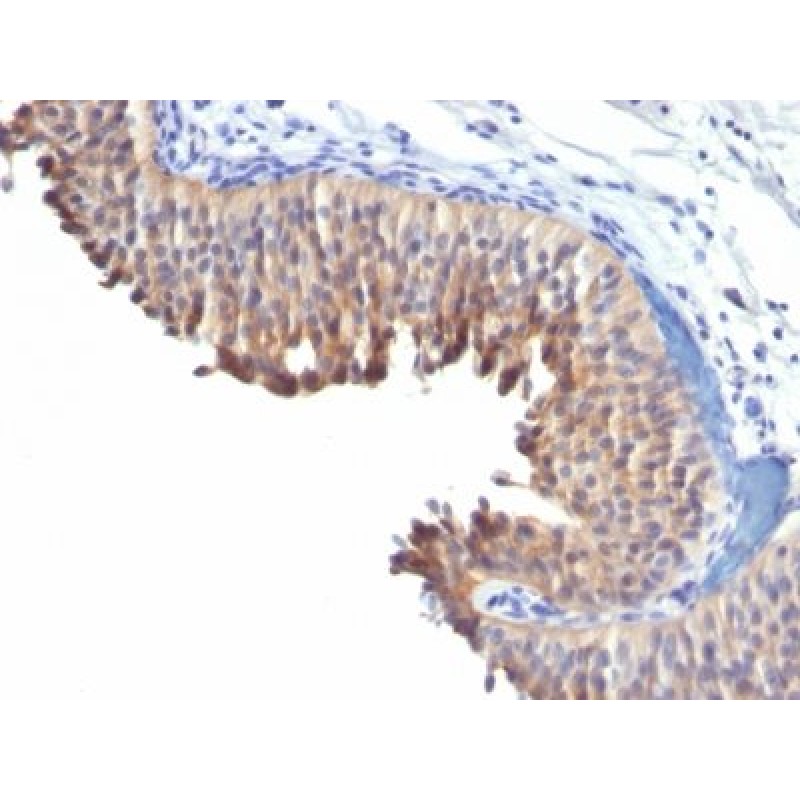 Cytokeratin 10(LH2), 1mg/mL
