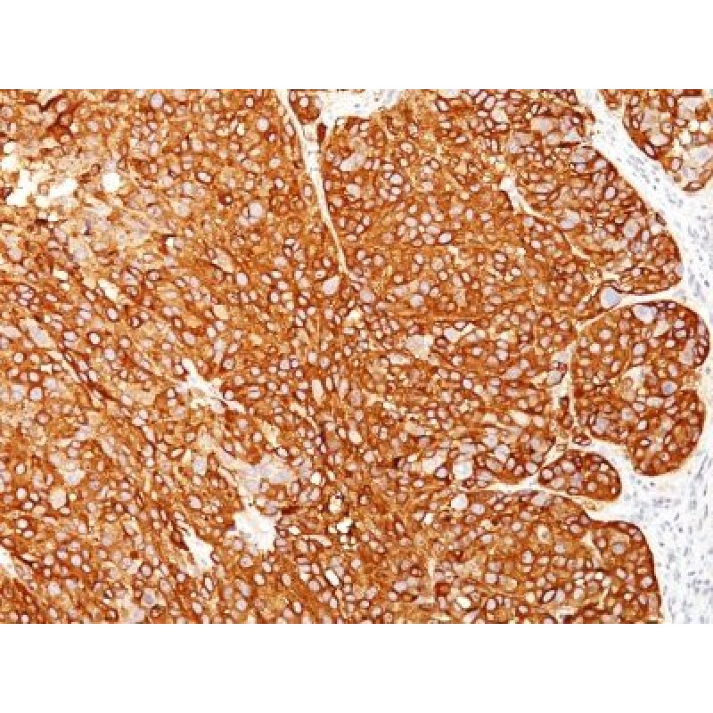 Melanoma Marker(HMB45 + M2-7C10 + M2-9E3 + T311), 1mg/mL
