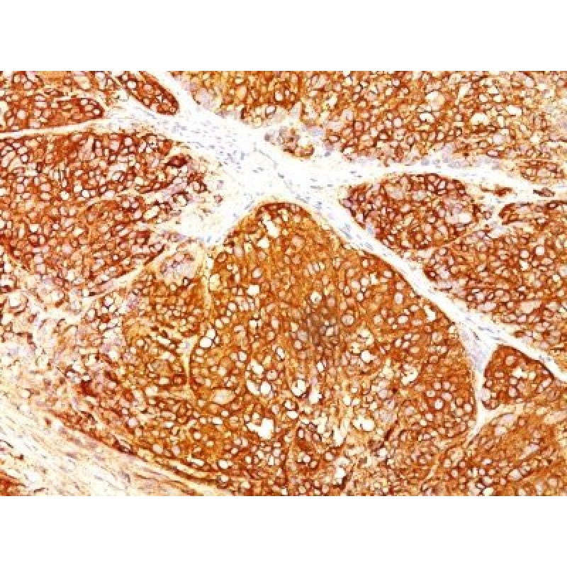 Melanoma Marker(HMB45 + A103 + T311), 1mg/mL