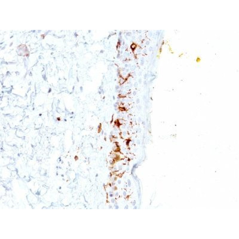 CD1a(C1A/711), 1mg/mL