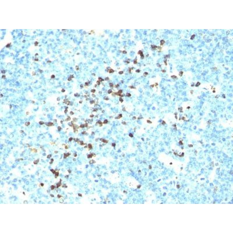Human IgM Immunoglobulin(DA4-4), 1mg/mL
