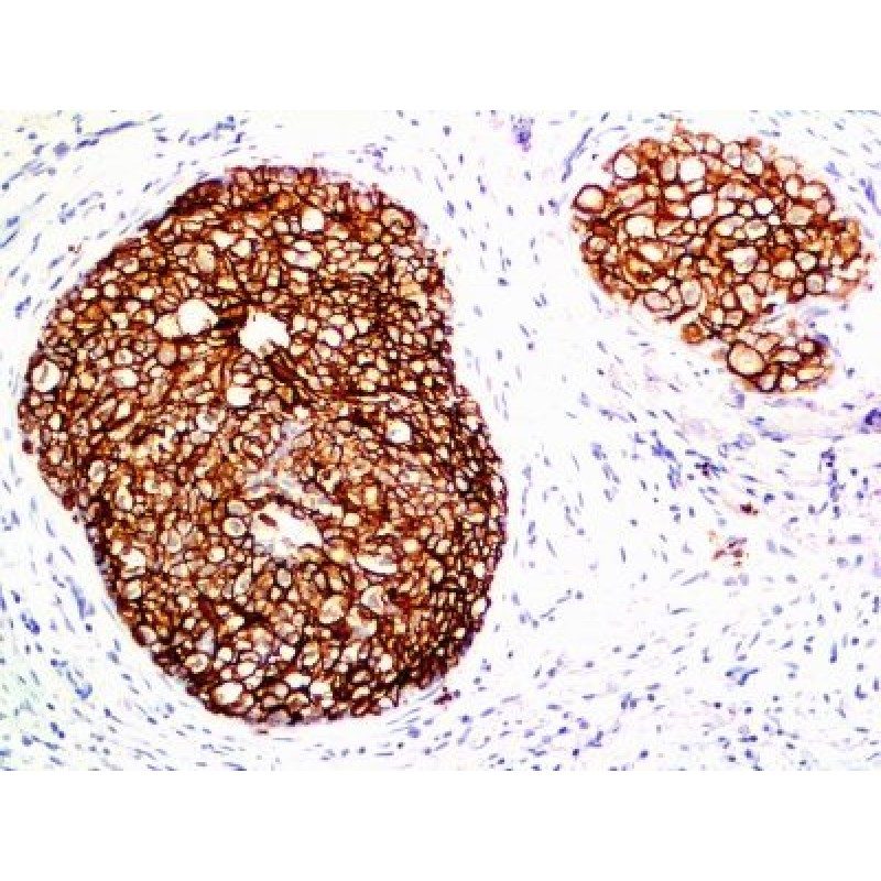 HER-2 / CD340(ERB2/776), 1mg/mL