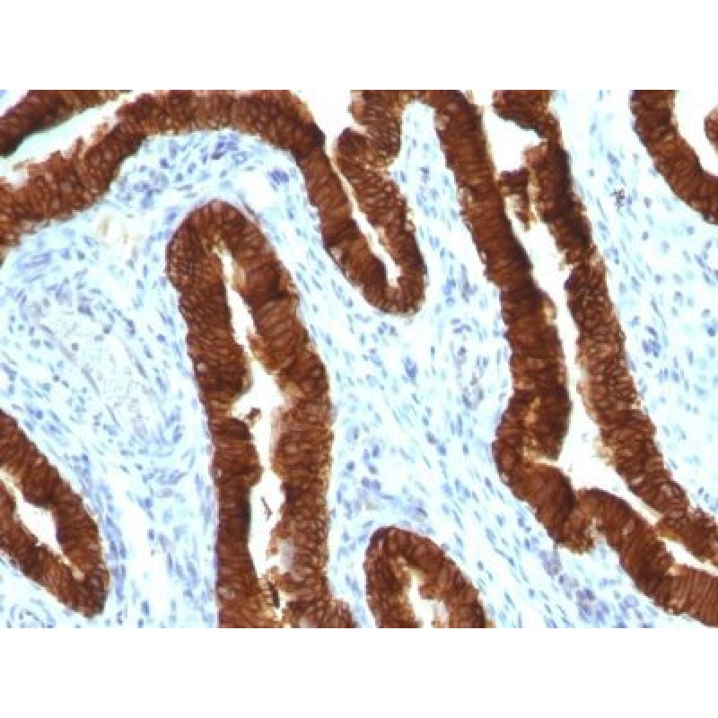 Cytokeratin 19(KRT19/800), 1mg/mL