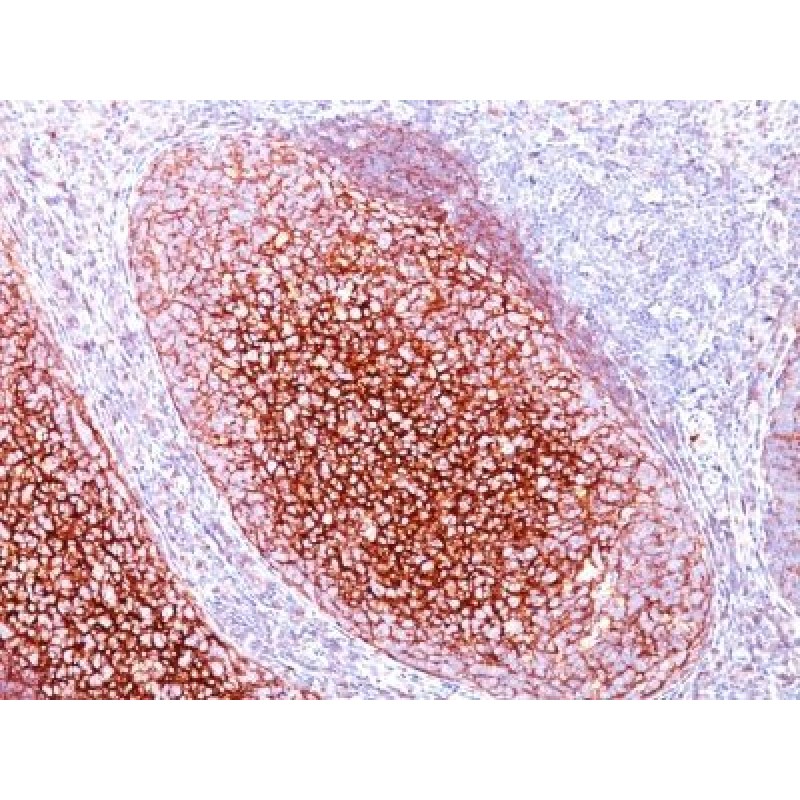 CD35 / CR1(CR1/802), 1mg/mL