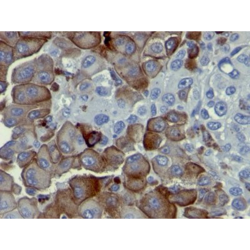 NGFR (Nerve Growth Factor Receptor)(NGFR5), 1mg/mL