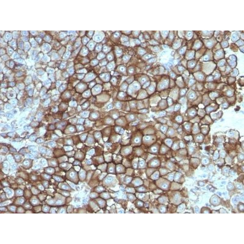 Melanoma Marker(KBA.62), 1mg/mL