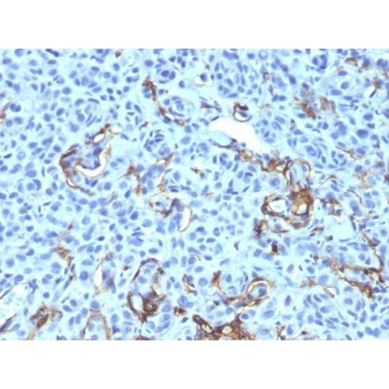NGFR (Nerve Growth Factor Receptor)(NGFR5 + NTR/912), 1mg/mL
