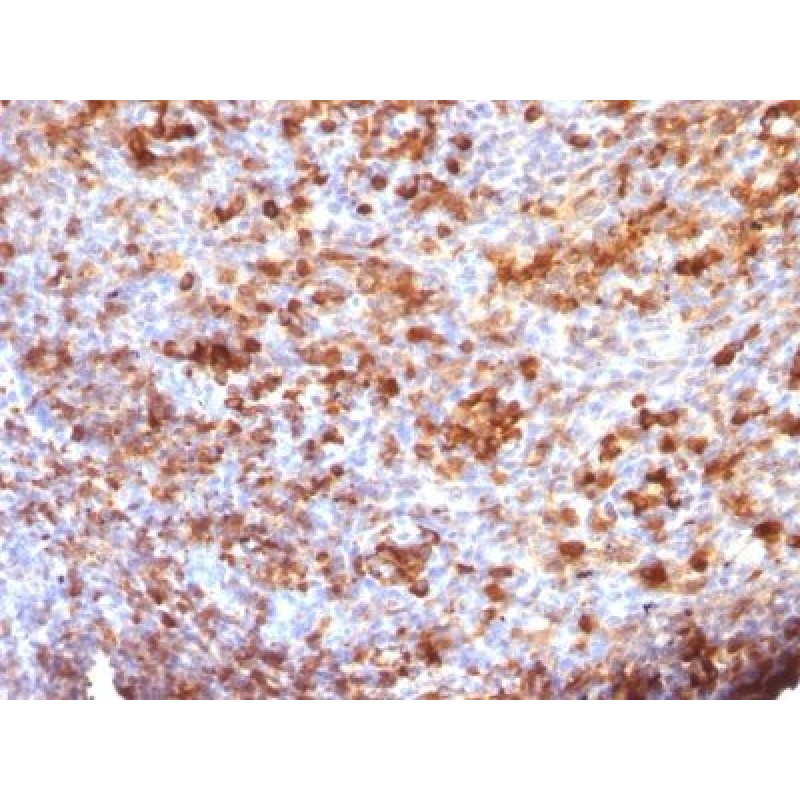Human IgG Immunoglobulin(B33/20), 1mg/mL