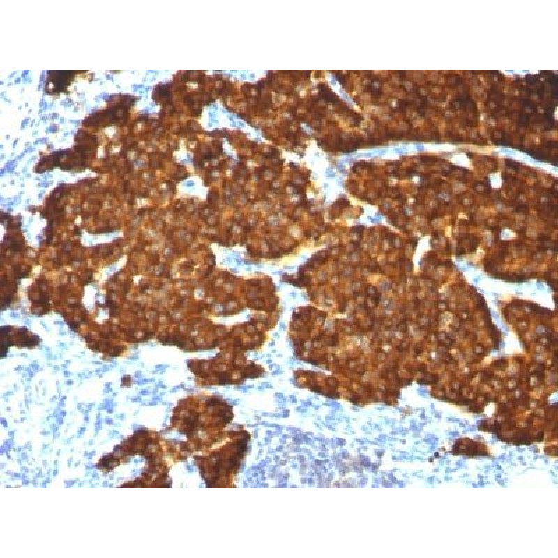 Chromogranin A(CGA414 + CGA/777 + CGA/798), 1mg/mL