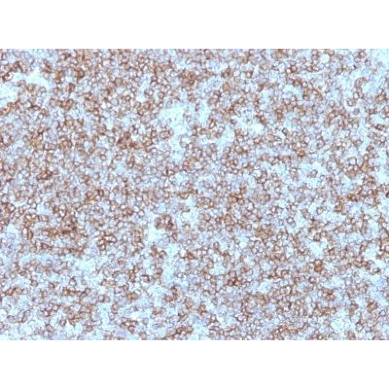 MHC II (HLA-DP) (beta chain)(Bra-14), 1mg/mL