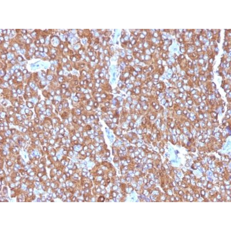 Chromogranin A(LK2H10 + PHE5 + CGA414), 1mg/mL