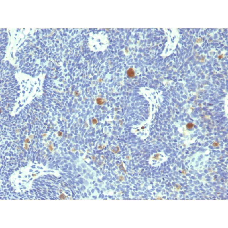 HPV-18 (Human Papilloma Virus 18)(HPV18/1297), 1mg/mL