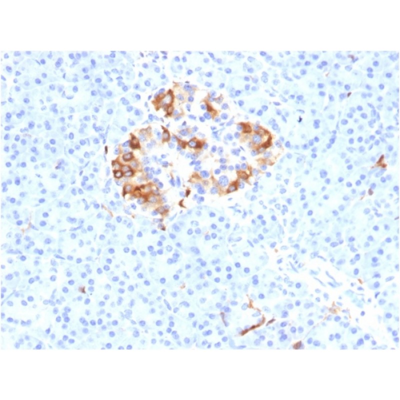 Ferritin, Light Chain (Node-Negative Breast Tumor Prognostic Marker)(FTL/1387), 1mg/mL