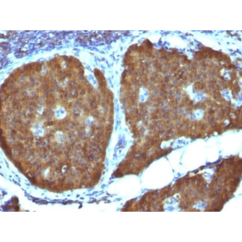 NSE gamma (Neuron Specific Enolase, gamma) (Neuroendocrine Marker) (ENO2/1462), 1mg/mL