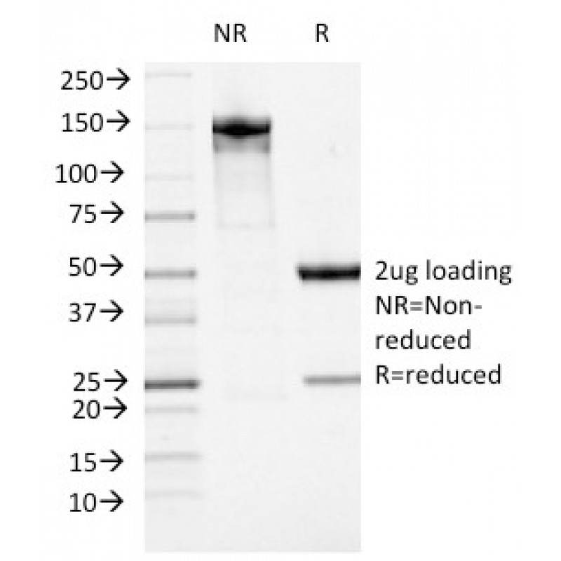 Biotium BNUM1474-50, ATRX / RAD54 (Alpha Thalassemia Mental Retardation)(23c), 1mg/mL