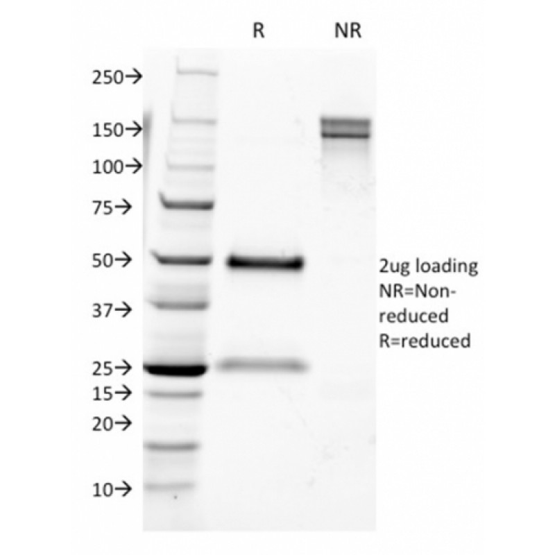 CD9 (TSPAN29) (Motility-Related Protein-1)(CD9/1631), 1mg/mL