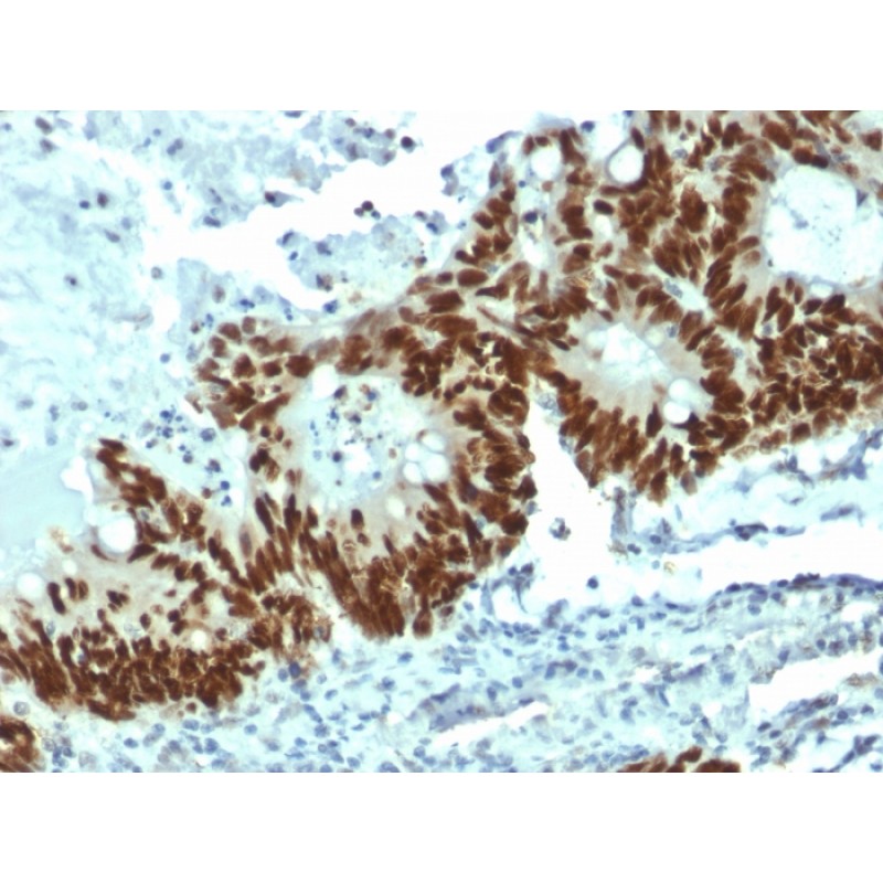 p53 Tumor Suppressor Protein(DO-1), 1mg/mL