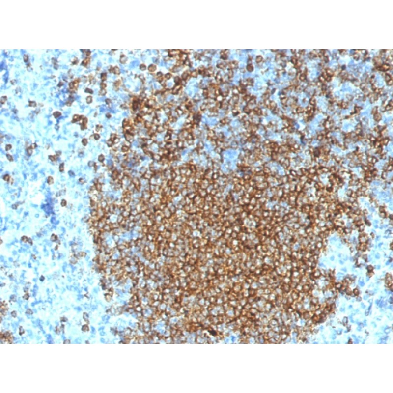 CD45RA (Leukocyte Marker)(K4B5), 1mg/mL