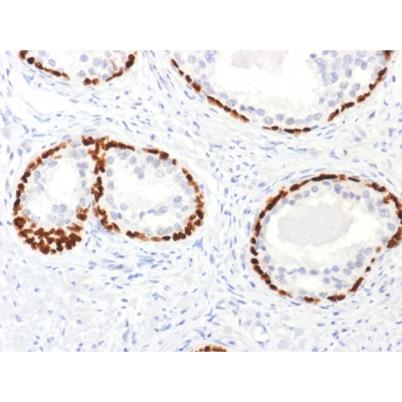 p63 (Squamous, Basal & Myoepithelial Cell Marker), 1mg/mL