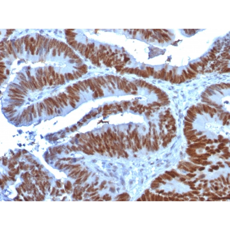 p53 Tumor Suppressor Protein(TP53/1739), 1mg/mL