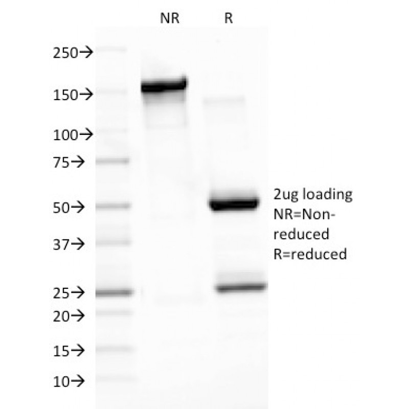 Epstein-Barr Virus (LMP-1)(CS3), 1mg/mL