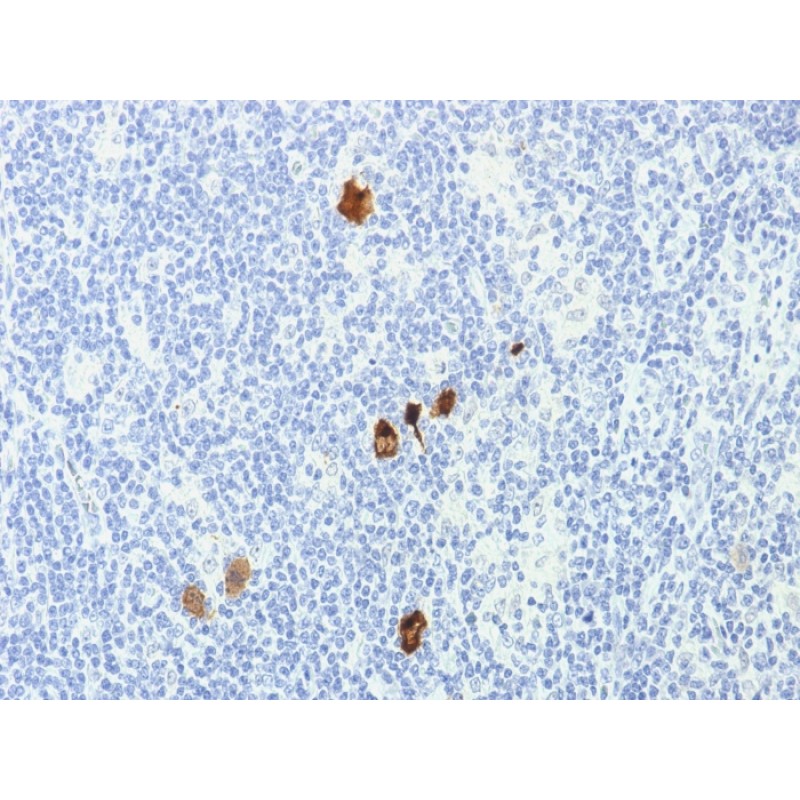 Epstein-Barr Virus (LMP-1)(CS1-4), 1mg/mL