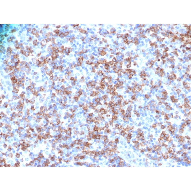 CD8A (Cytotoxic- & Suppressor T-Cell Marker)(N/A), 1mg/mL