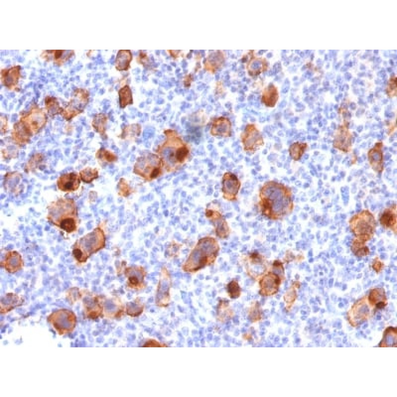CD30 / TNFRSF8 (Hodgkin & Reed-Sternberg Cell Marker) (rKi-1/779), 1mg/mL