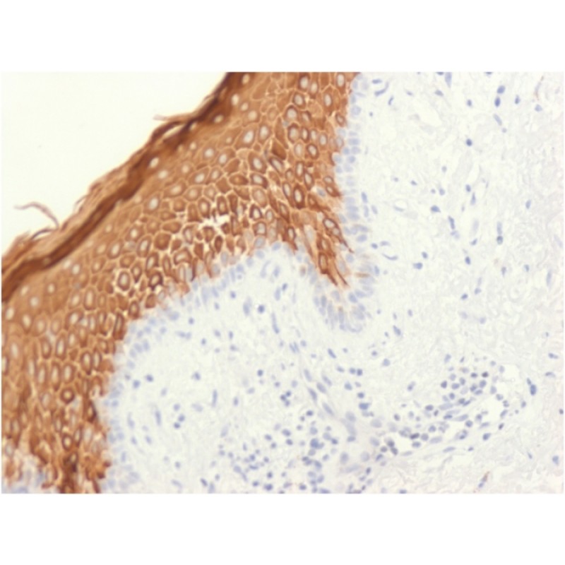 Cytokeratin 10 (Suprabasal Epithelial Marker)(KRT10/1948R), 1mg/mL