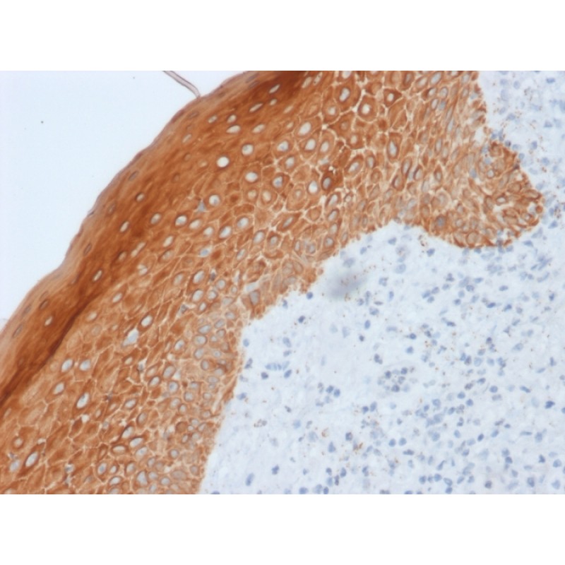 Cytokeratin 5/6/18(LP34), 1mg/mL