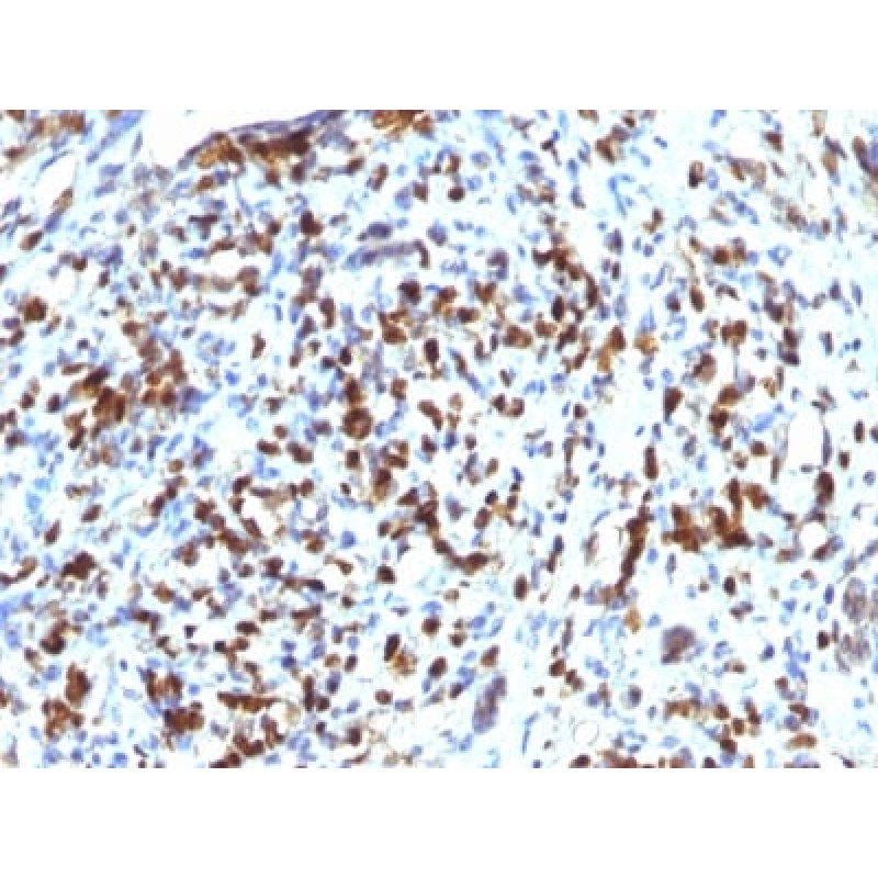 MyoD1 (Rhabdomyosarcoma Marker) (MYOD1/2075R), 1mg/mL
