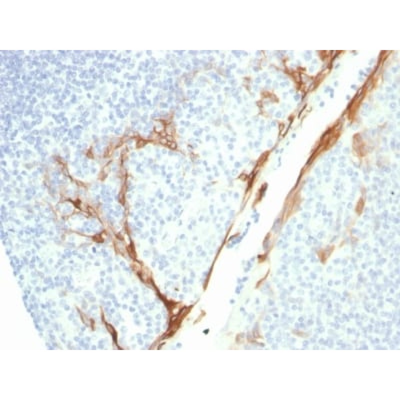 Cytokeratin 16 (KRT16) (Suprabasal Keratinocyte Marker) (rKRT16/1714), 1mg/mL