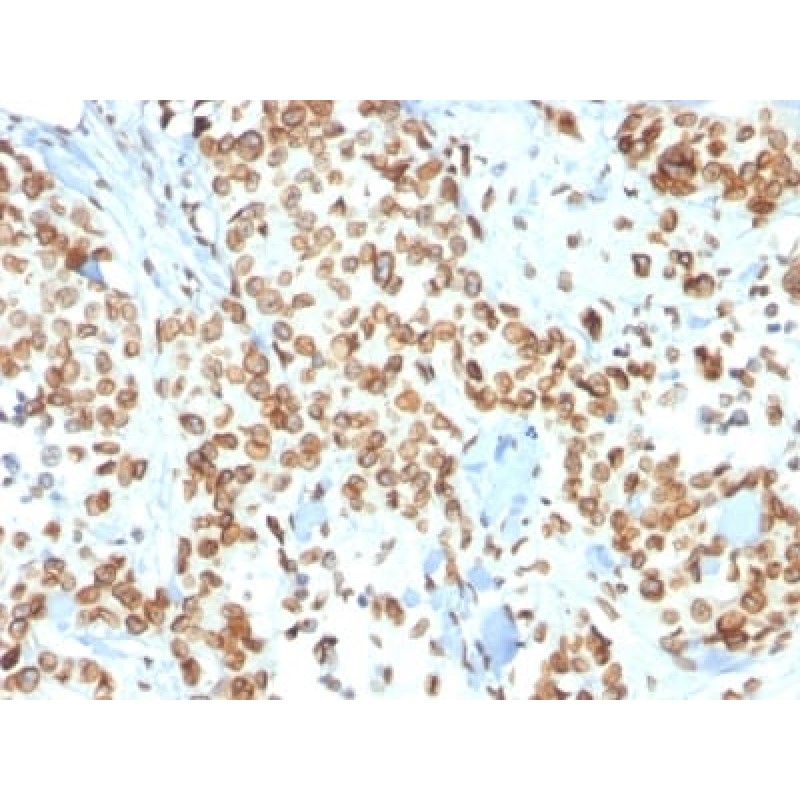 Emerin (Papillary Thyroid Carcinoma and EDMD Marker) (EMD/2167), 1mg/mL