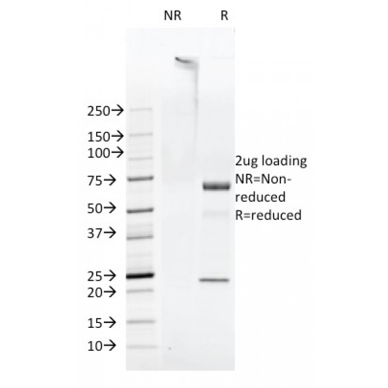 FAT1 (FAT atypical cadherin 1)(FAT1-3D7/1), 1mg/mL
