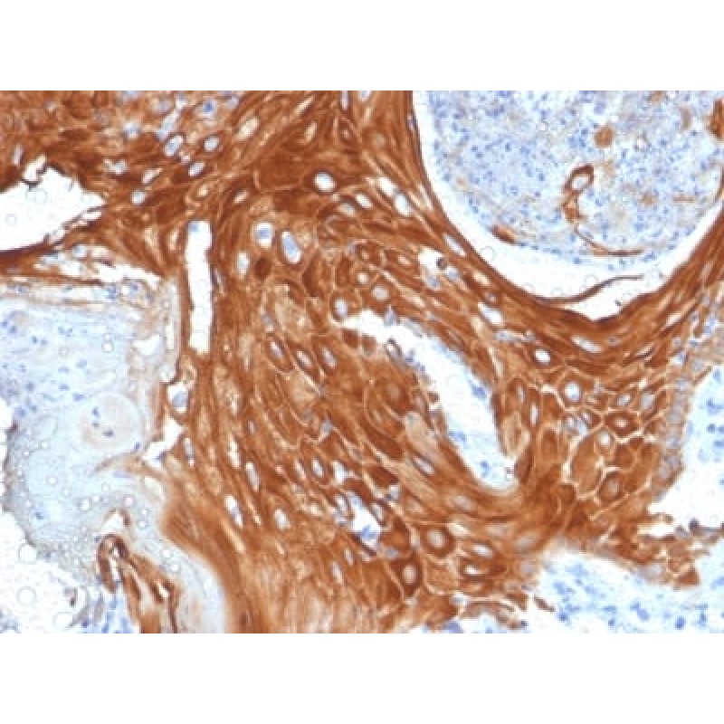 Cytokeratin 6A (KRT6A) (Basal Cell Marker) (KRT6A/2368), 1mg/mL