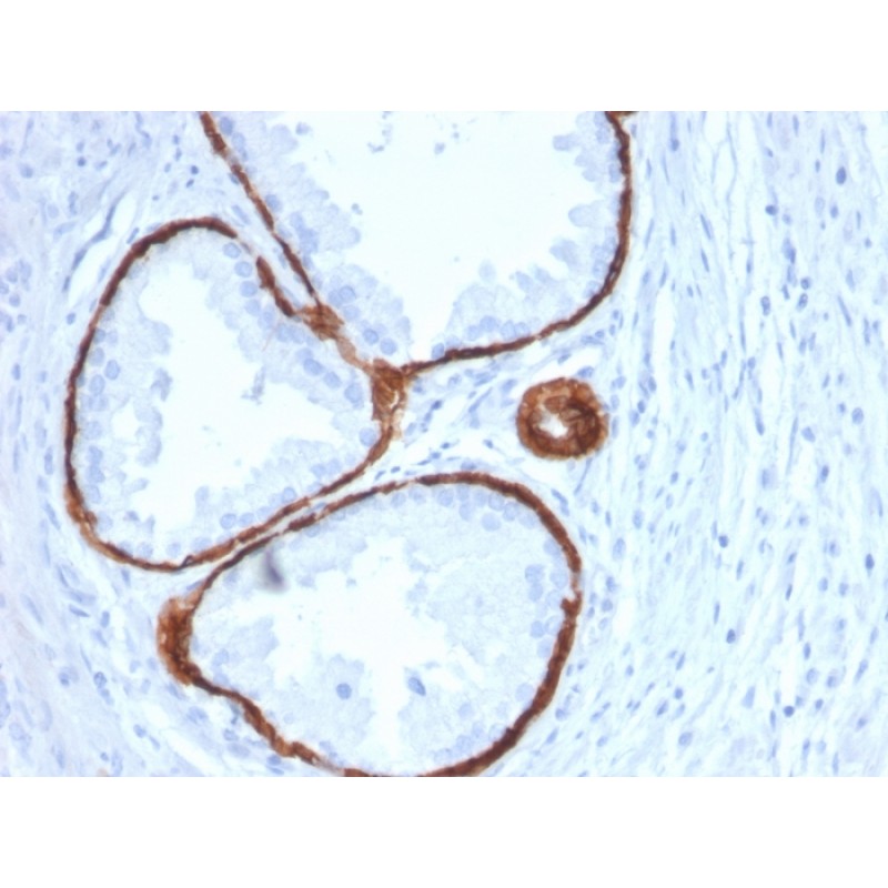 Cytokeratin 14 (KRT14) (Squamous Cell Marker)(KRT14/2375), 1mg/mL