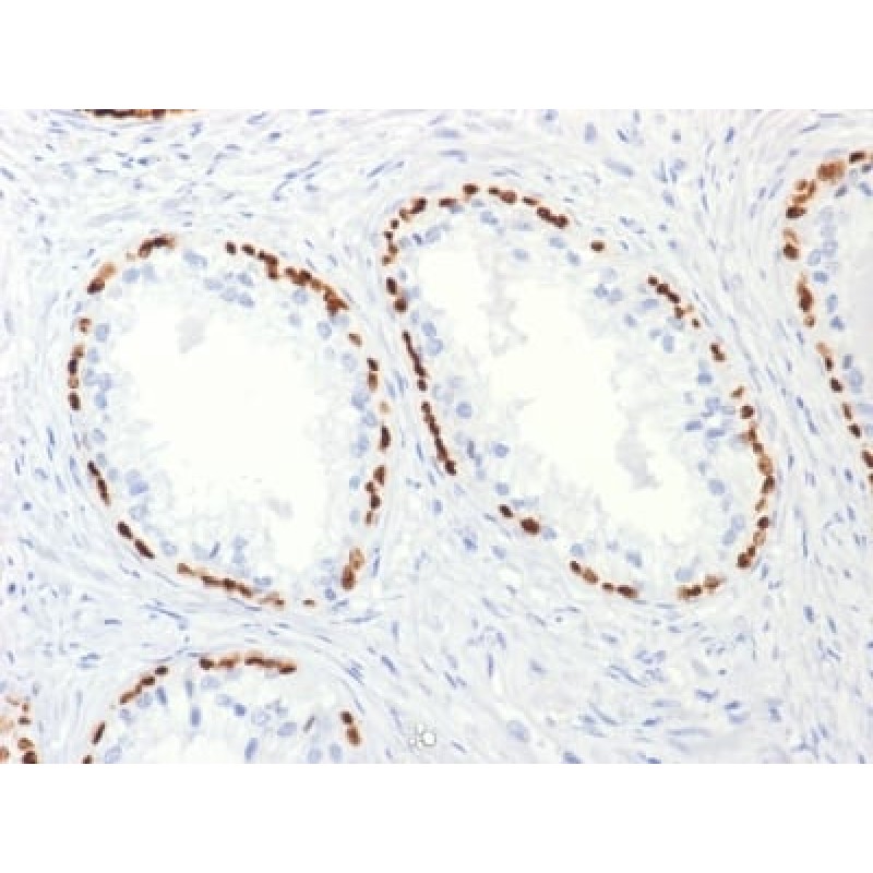 p63 (Squamous, Basal & Myoepithelial Cell Marker) (TP63/2427), 1mg/mL