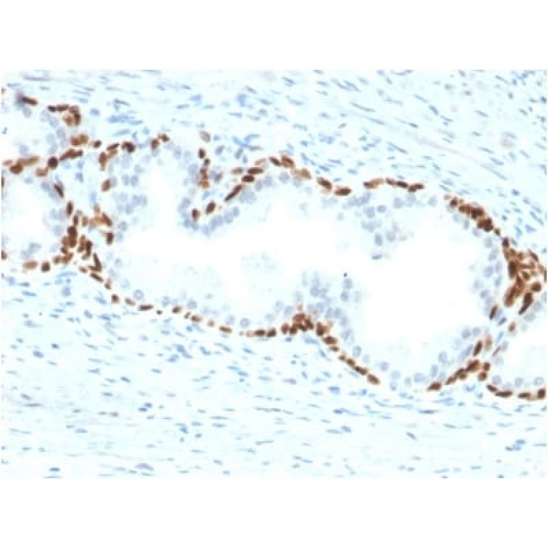 p63 (Squamous, Basal & Myoepithelial Cell Marker) (TP63/2428), 1mg/mL