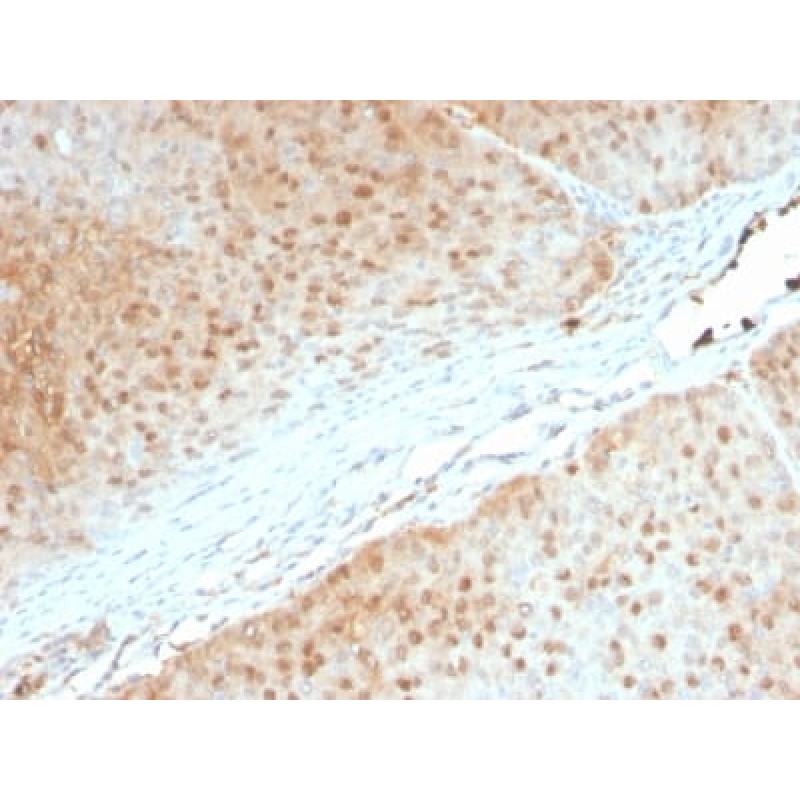Biotium BNUM2552-50, AKT1 (Prognostic Marker for Neuroendocrine Tumors) (AKT1/2552), 1mg/mL