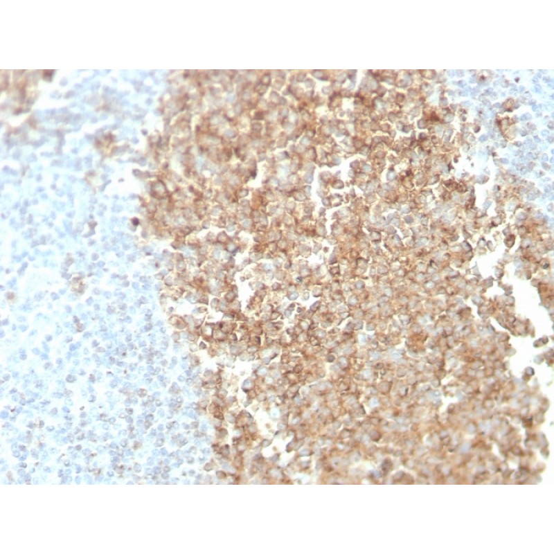 CDw75 (B-Cell Marker)(ZB55), 1mg/mL