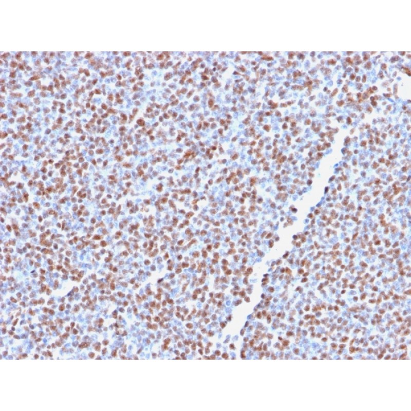 Biotium BNUM2766-50, ALK (Anaplastic Lymphoma Kinase) / CD246(ALK1/2766R), 1mg/mL