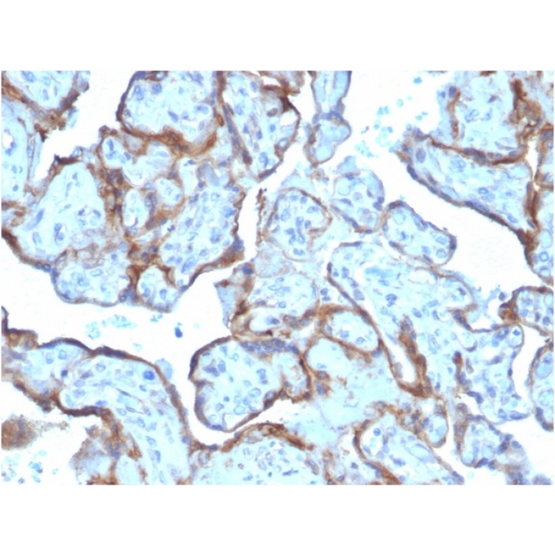 MMP3 (Marker of Metastasis and Rheumatoid Arthritis)(MMP3/2806), 1mg/mL