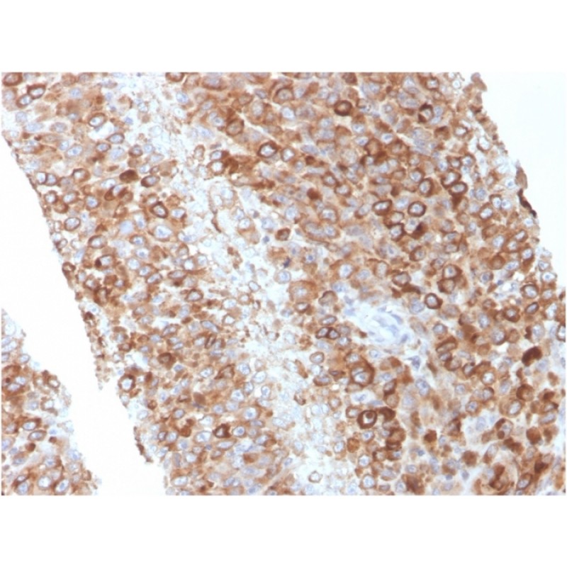 CD63 (Late Endosomes Marker)(LAMP3/2881), 1mg/mL