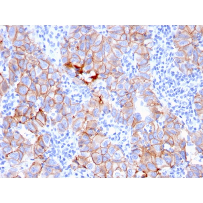 HER-2 / c-erbB-2 / neu / CD340(ERBB2/3080), 1mg/mL