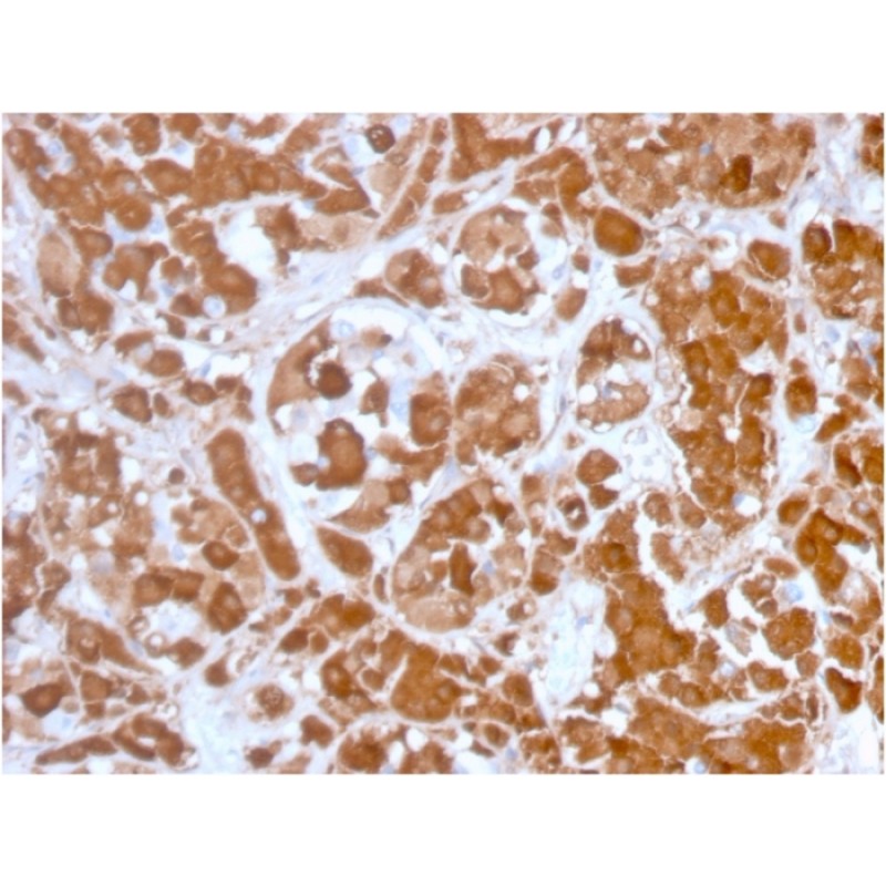 Growth Hormone (Pituitary Marker)(GH/3155), 1mg/mL