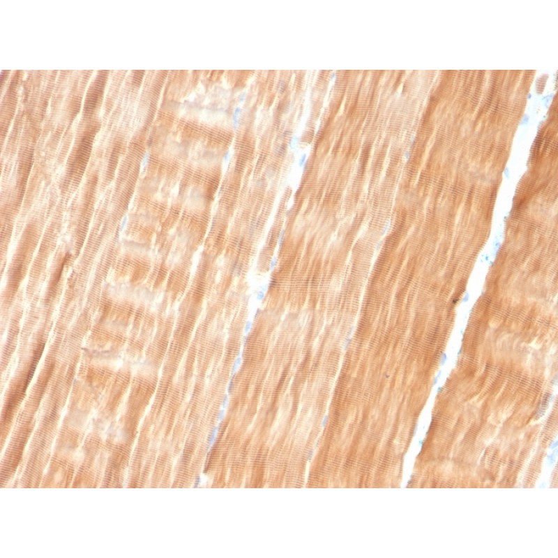 Sarcomeric Actinin Alpha 2 / ACTN2(ACTN2/3293), 1mg/mL