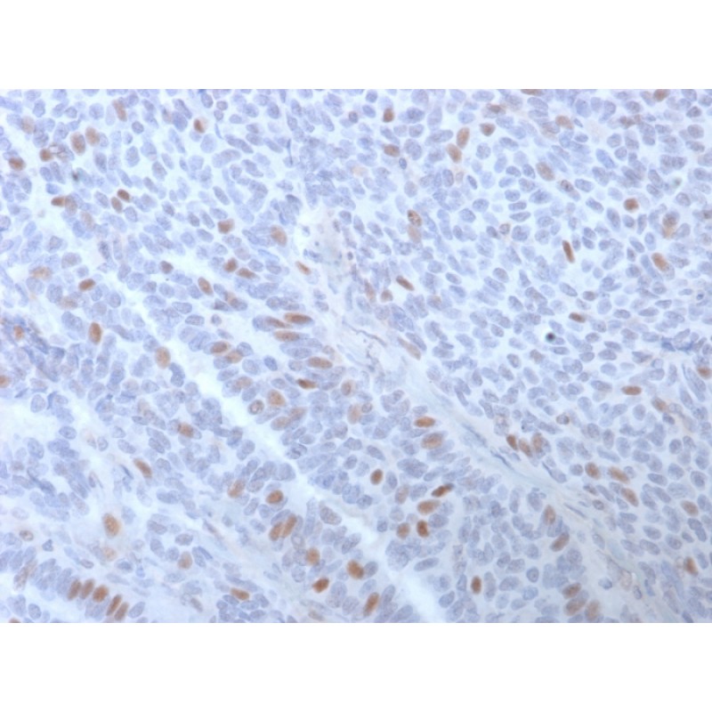 Estrogen Receptor, alpha (Marker of Estrogen Dependence)(ESR1/3373), 1mg/mL