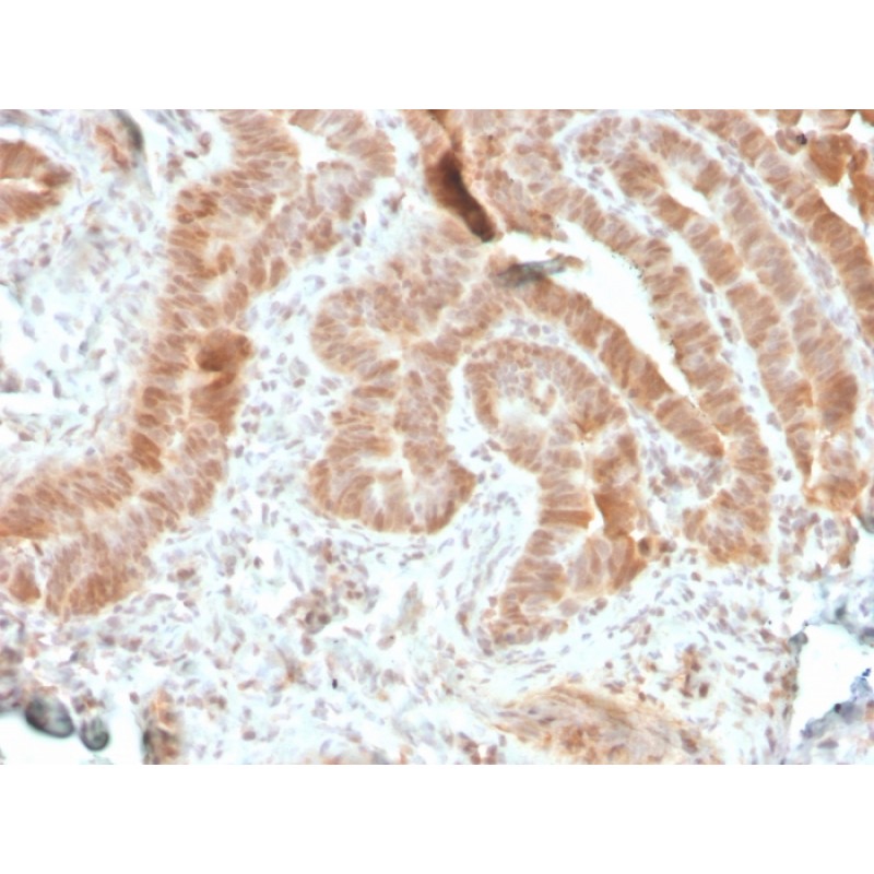 Biotium BNUM3786-50, AKT1 (Prognostic Marker for Neuroendocrine Tumors)(rAKT1/2491), 1mg/mL